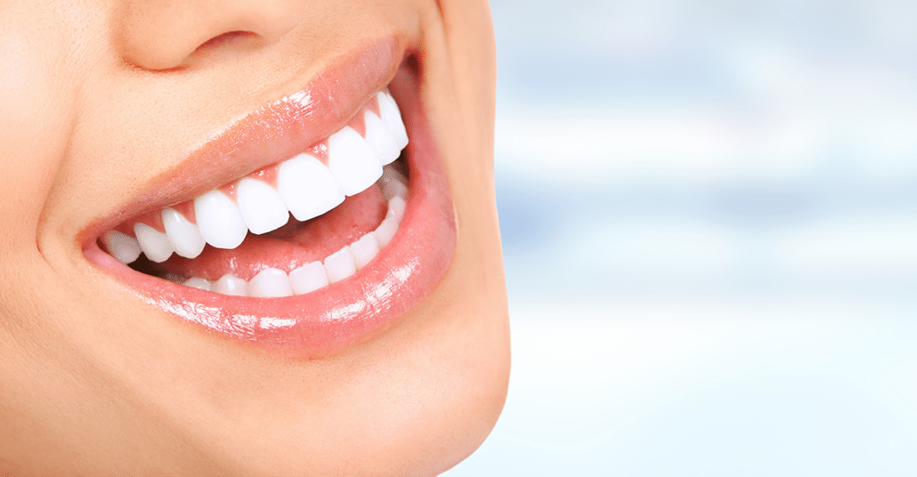 Pulizia dei Denti e Sbiancamento